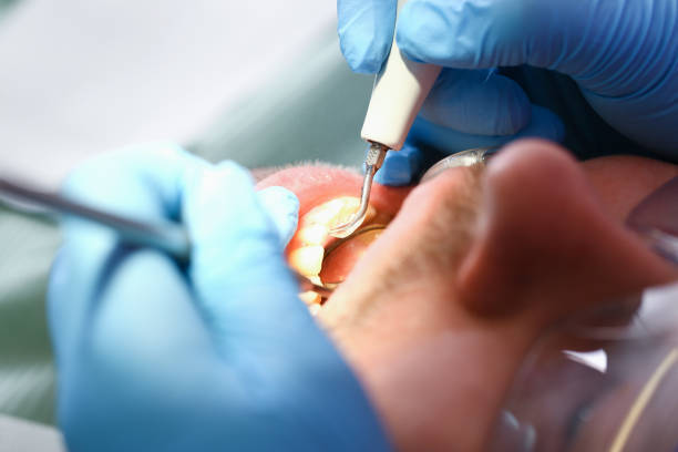 Best Emergency Treatment for Toothache in Whitehorn Cove, OK