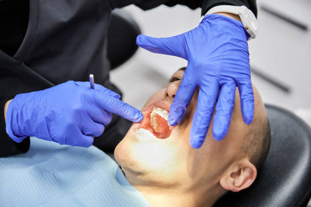 Best Emergency Root Canal Treatment in Whitehorn Cove, OK